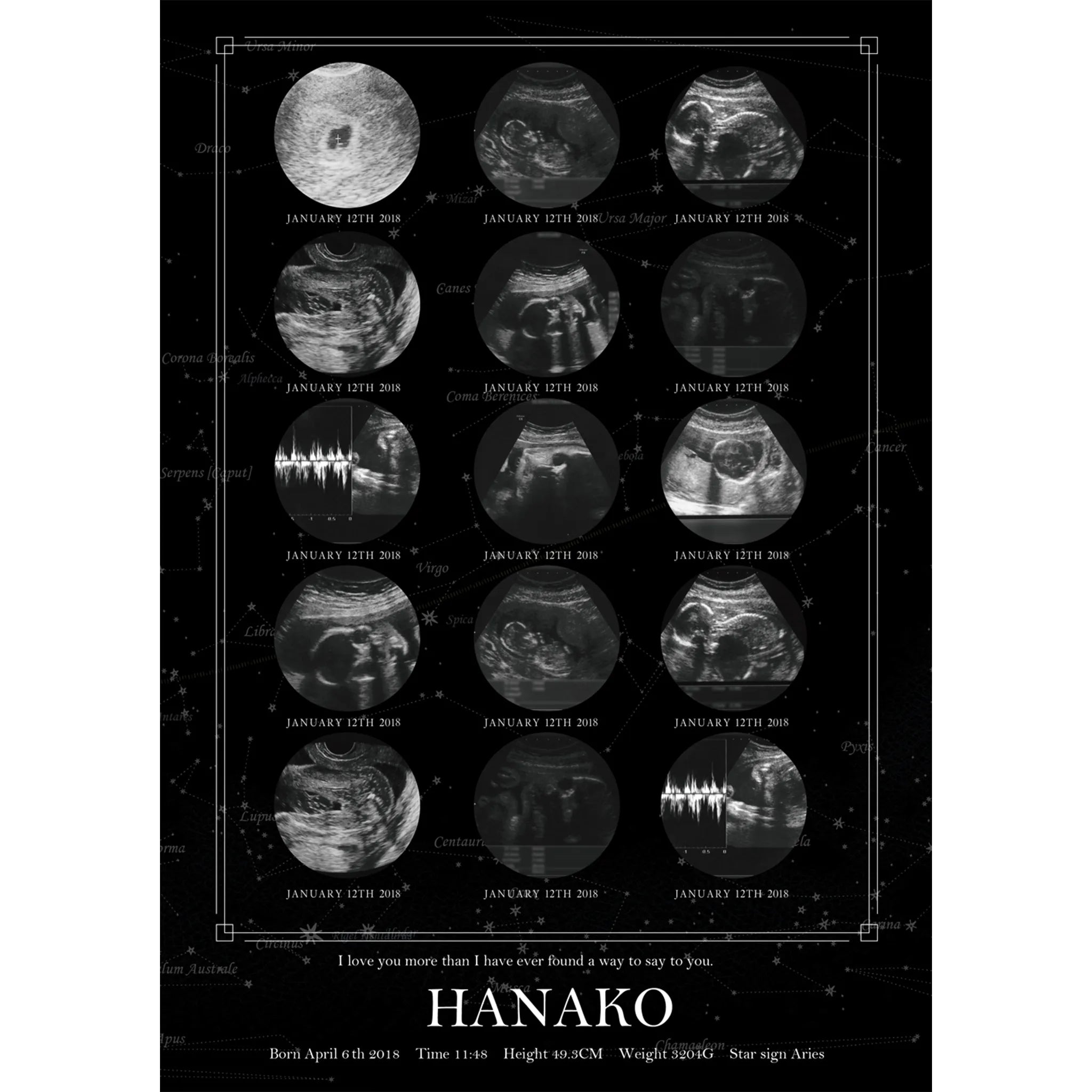 実際の星空を背景に エコー写真ポスター【15枚ver.】