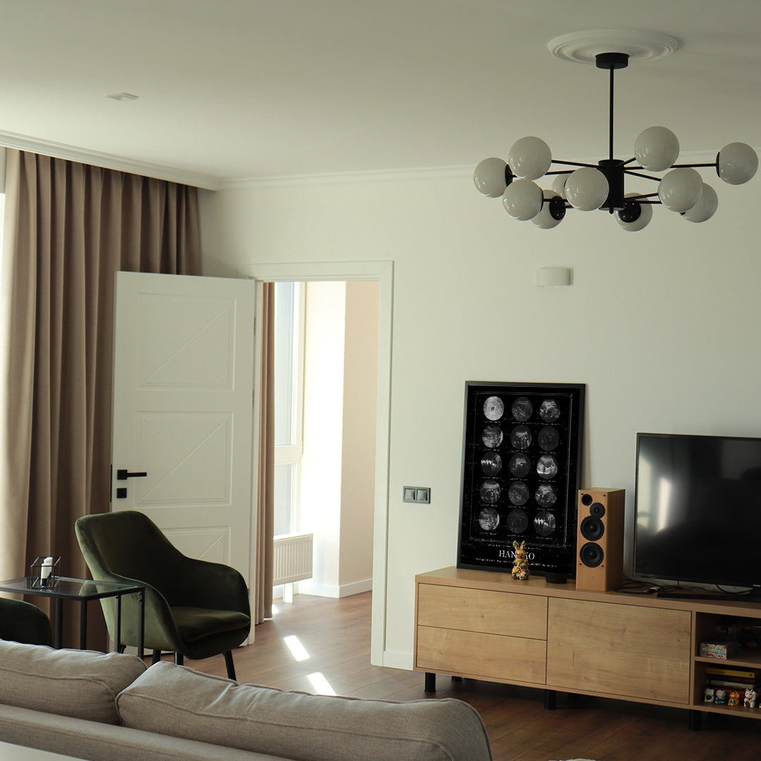 実際の星空を背景に エコー写真ポスター【15枚ver.】