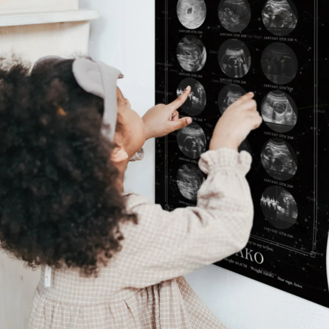 実際の星空を背景に エコー写真ポスター【15枚ver.】