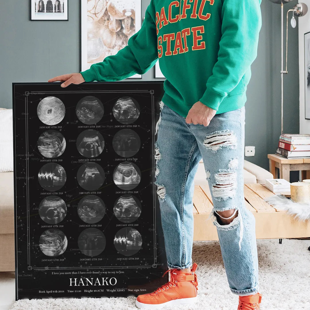 実際の星空を背景に エコー写真ポスター【15枚ver.】