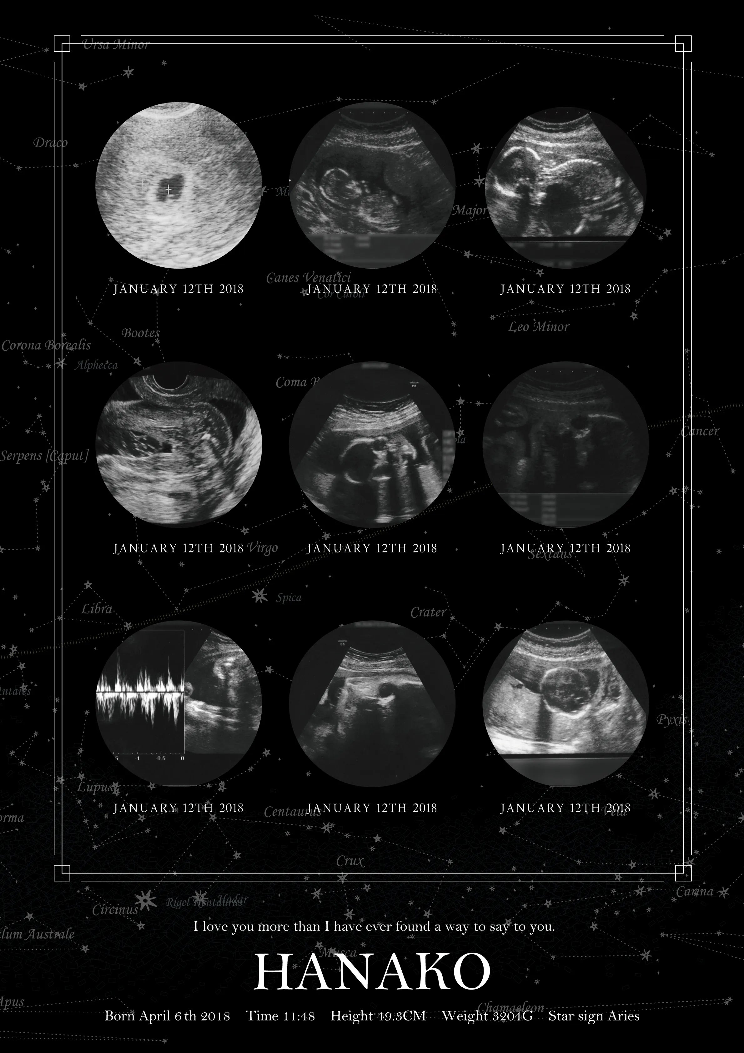 実際の星空を背景に【エコー写真ポスター9枚ver.】