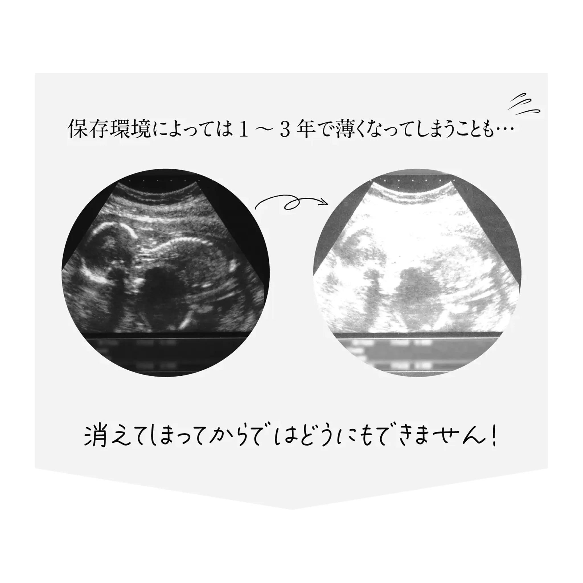 実際の星空を背景に エコー写真ポスター【15枚ver.】