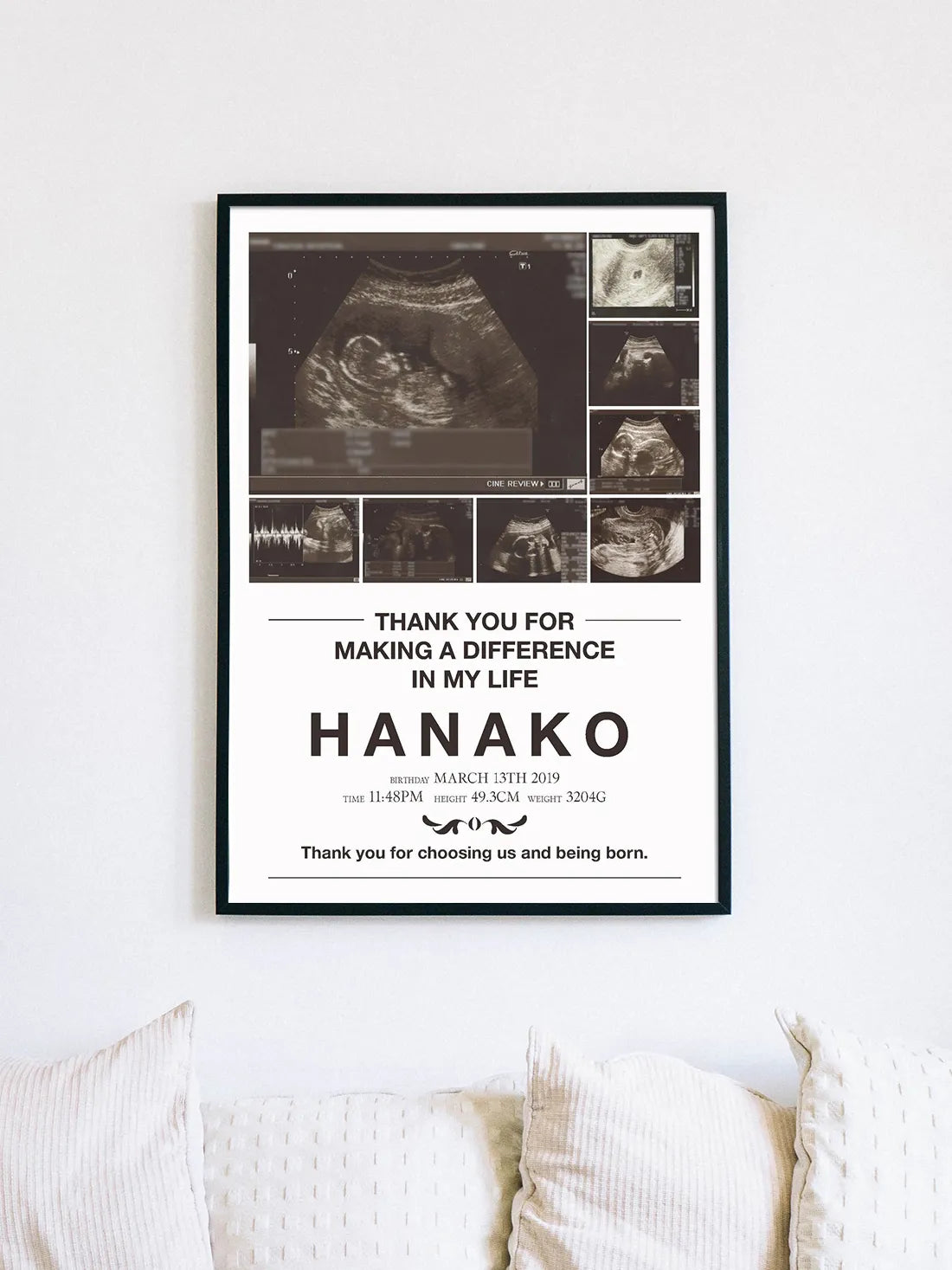 エコー写真ポスター