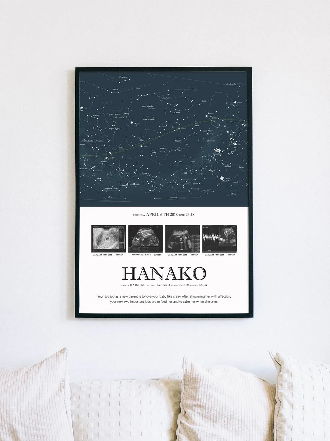 エコー写真ポスター