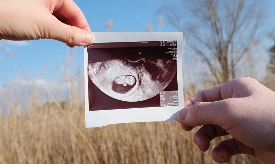 【制作会社が解説】エコー写真が色褪せる3つの原因と今すぐできる対策